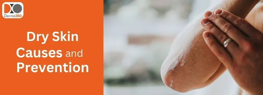 Dry Skin Causes and Prevention