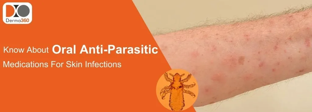 Know About Oral Anti-Parasitic Medications For Skin Infections And Their Treatment