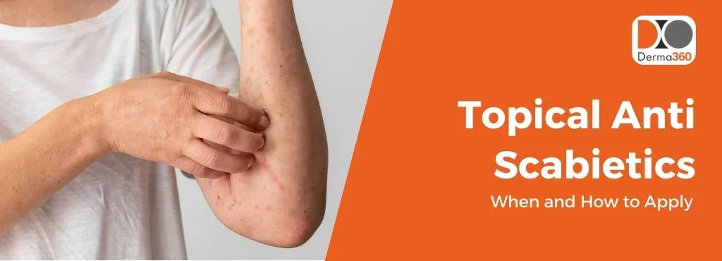 Topical Anti Scabietics