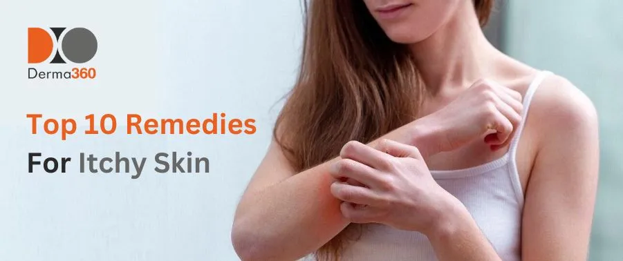 Top 10 Remedies for Itchy Skin