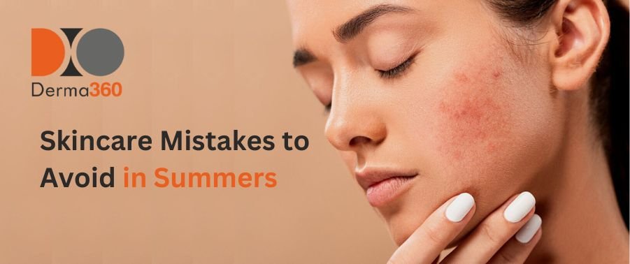 Skincare Mistakes to Avoid in Summers