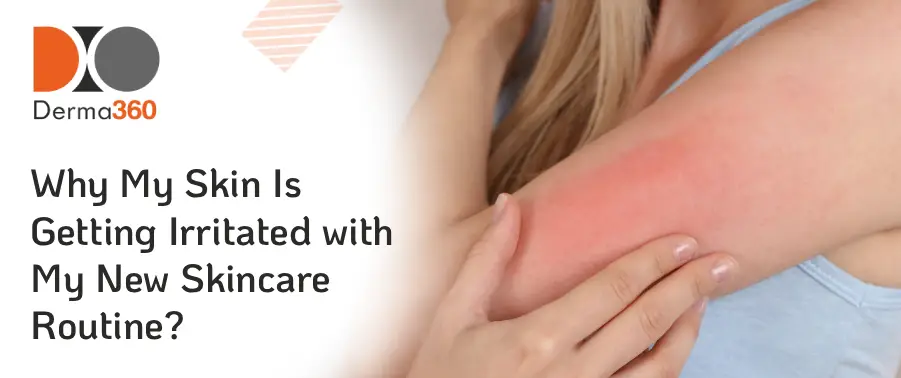 Why My Skin Is Getting Irritated with My New Skincare Routine?